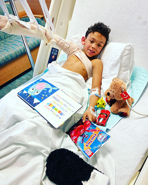 Kayson Metcalf was treated at the Arnold Luterman Regional Burn Center at University Hospital.